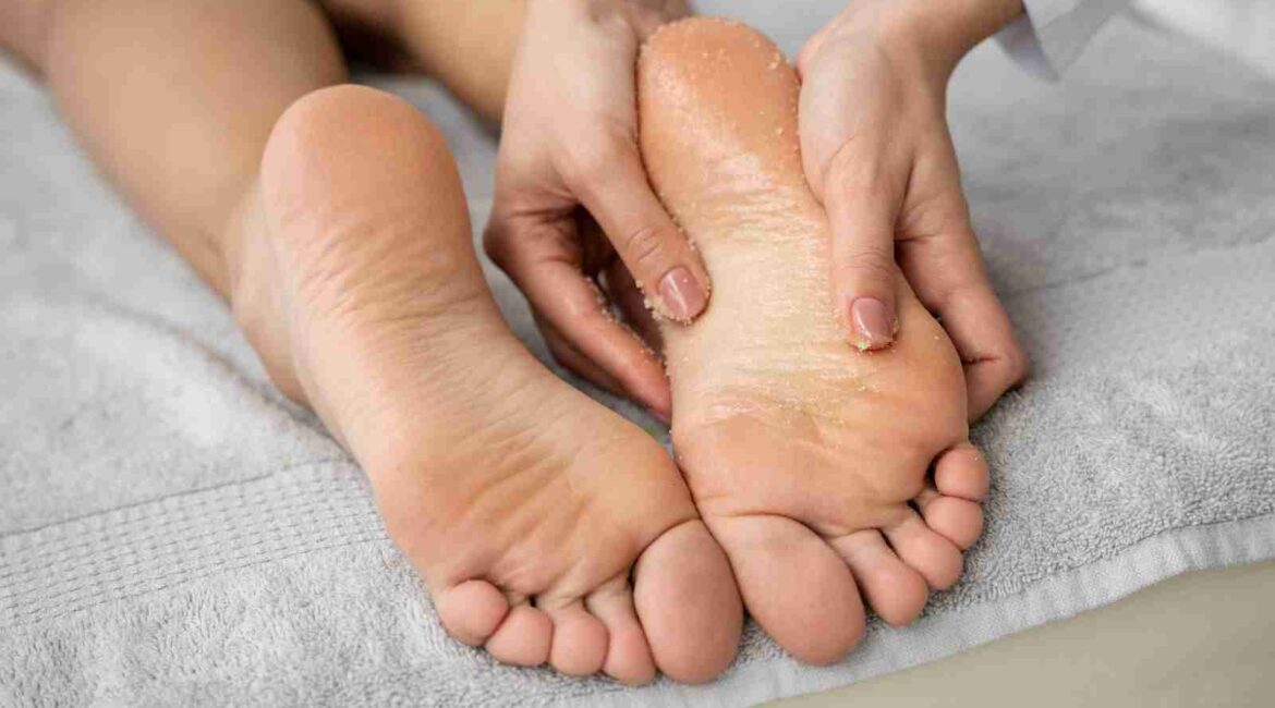 Why Are My Feet So Dry Even When I Moisturize and How to Fix